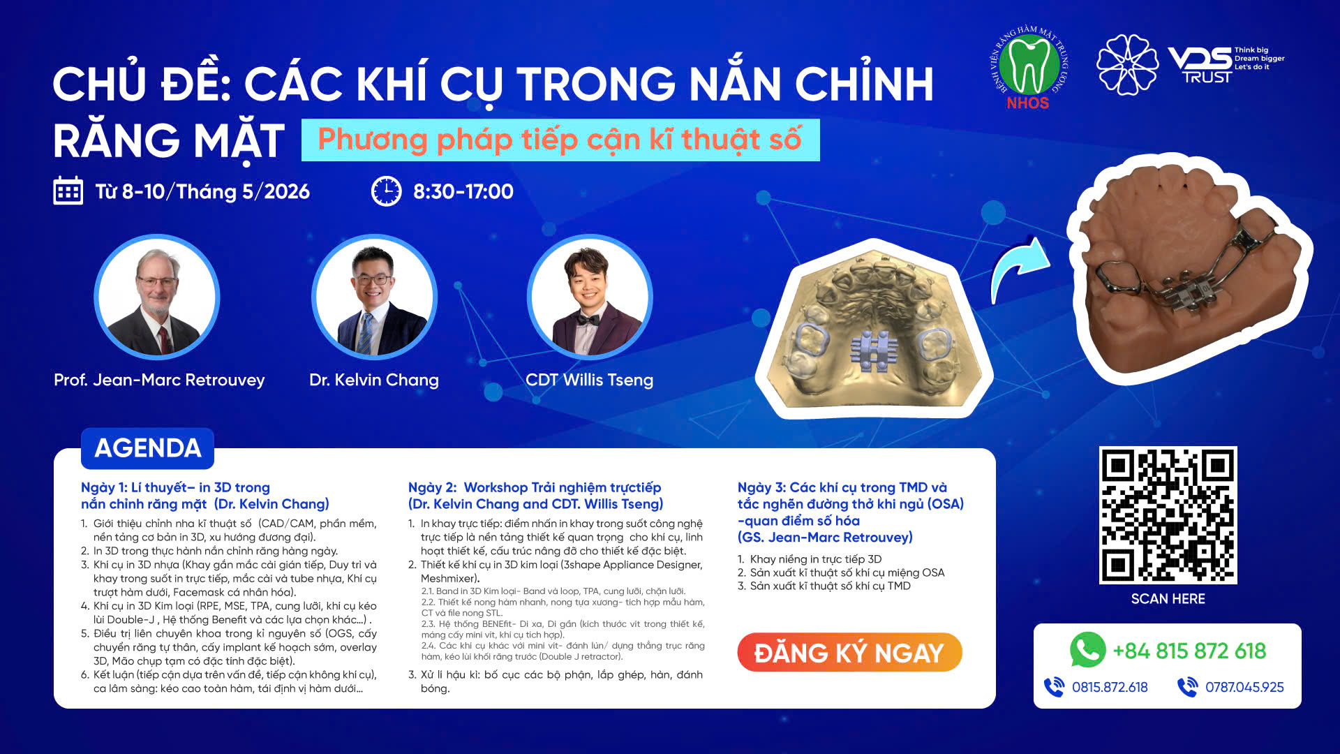 CÁC KHÍ CỤ TRONG NẮN CHỈNH RĂNG MẶT – BƯỚC TIẾN MỚI CỦA CHỈNH NHA KỸ THUẬT SỐ